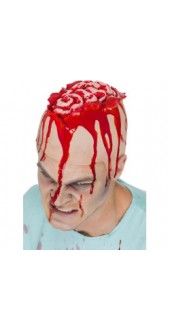 Open Brain Head Cap
